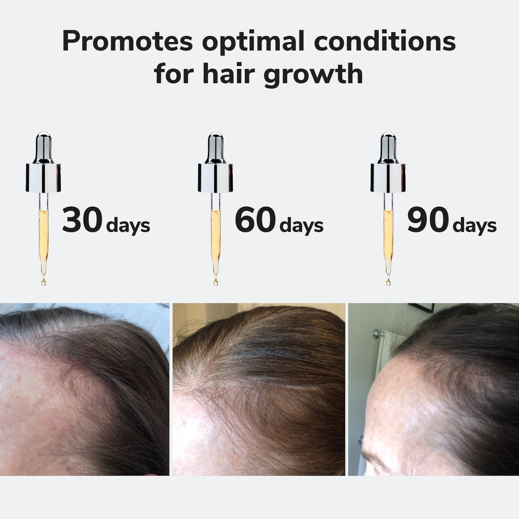 Youth Juice Scalp Treatment